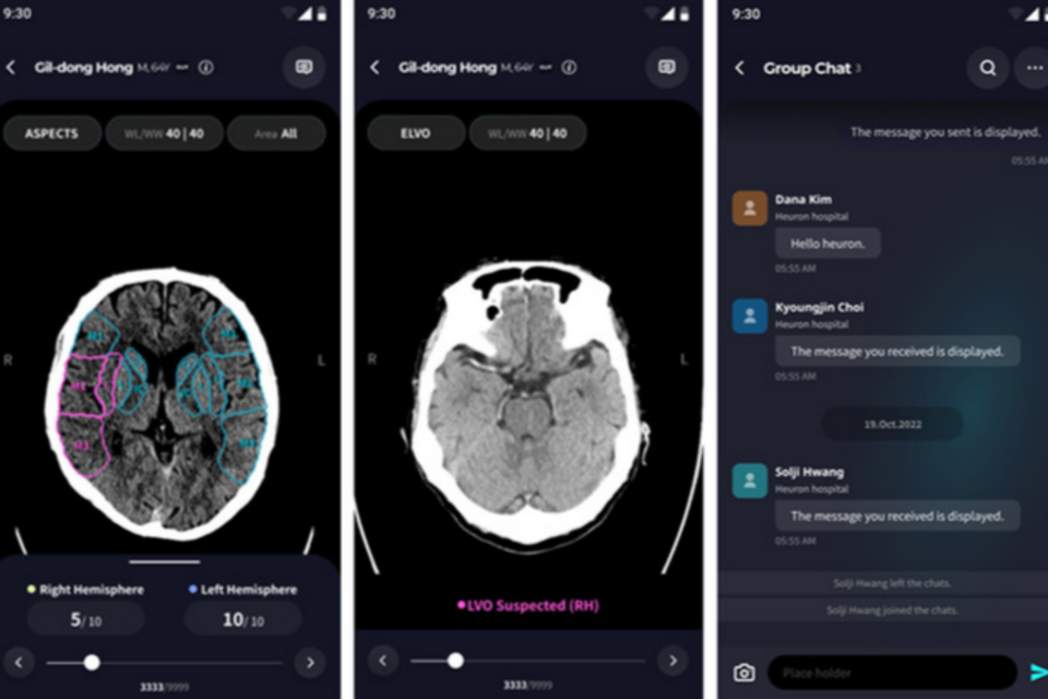 21일 뇌신경 질환 전문 의료 AI 기업 휴런은 비조영 컴퓨터단층촬영(CT) 기반 응급 뇌졸중 선별 인공지능 솔루션 '휴런 스트로케어 스위트(Heuron StroCare Suite)'의 모바일 어플리케이션을 출시했다고 밝혔다. (사진=휴런)