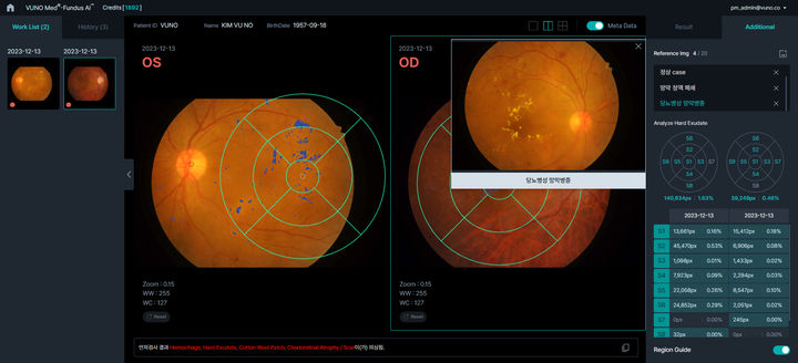 뷰노메드 펀더스 AI 화면. (사진=뷰노)