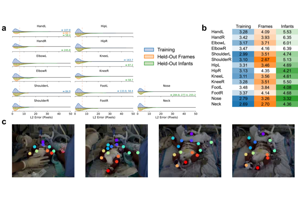 (사진=뉴욕 마운트 시나이 아이칸 의대)
