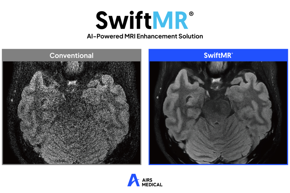 에어스메디컬 ‘스위프트엠알(SwiftMR)’. (사진=에어스메디컬)