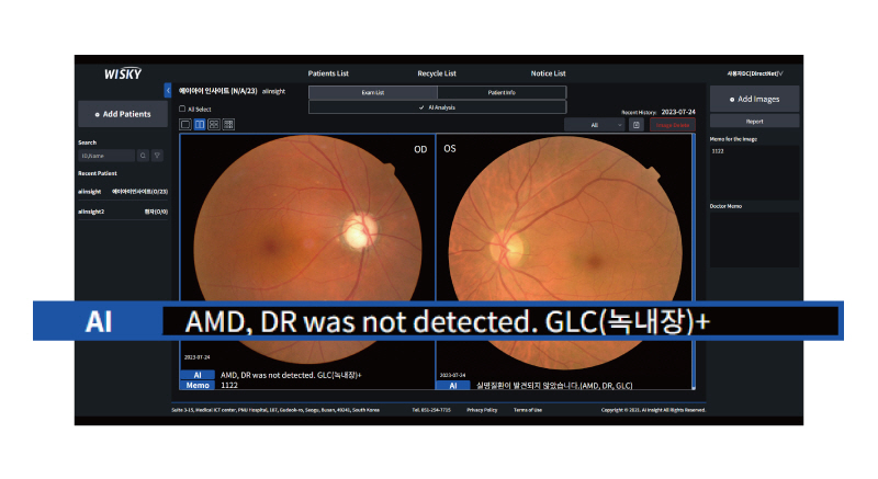 AI 실명질환 진단 보조 솔루션 ‘위스키(WISKY)'의 판독 이미지. (사진=아크)