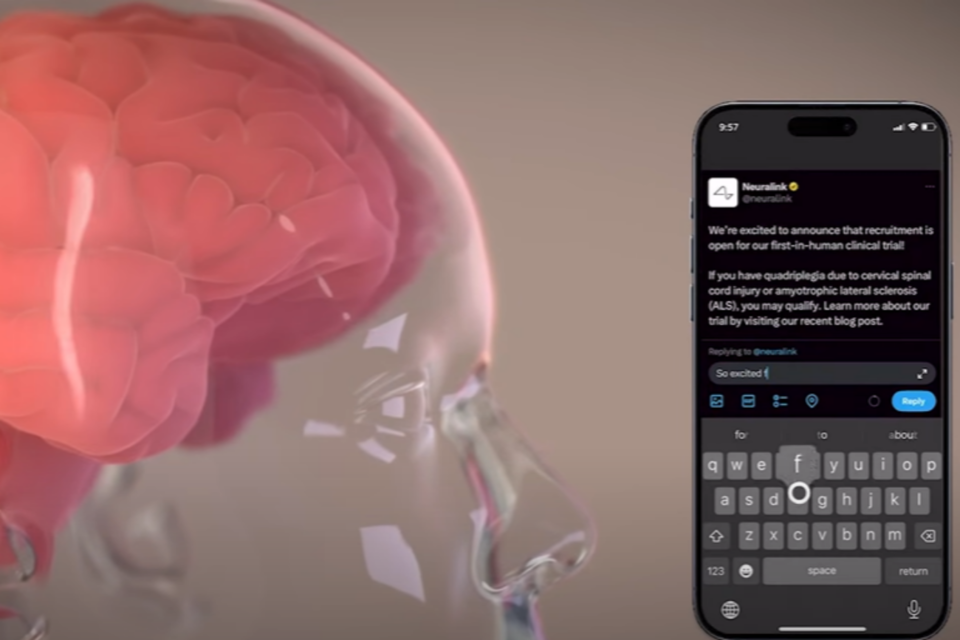 (사진=뉴럴링크)