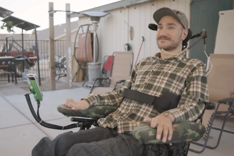 뉴럴링크의 컴퓨터 칩을 뇌에 이식한 놀랜드 아르보. (사진=뉴럴링크)