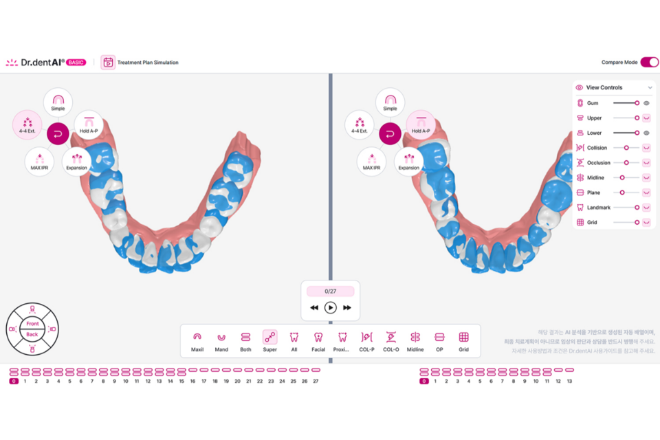 이노디테크 닥터덴트AI 시뮬레이션 서비스. (사진=이노디테크)