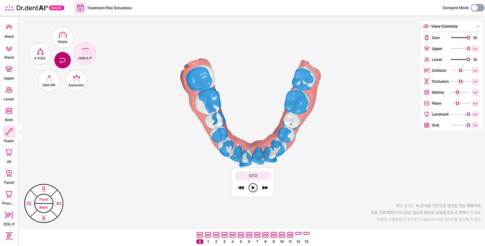 이노디테크 닥터덴트AI 시뮬레이션 서비스. (사진=이노디테크)
